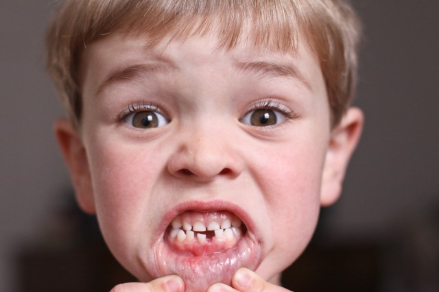 Hilarious Excuses to Try When the Tooth Fairy Forgets to Visit
