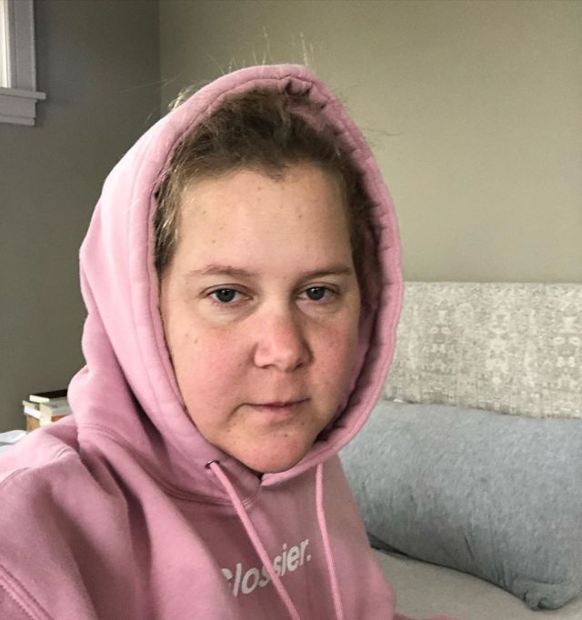 Amy Schumer Shares Incredibly Honest Post About Undergoing IVF