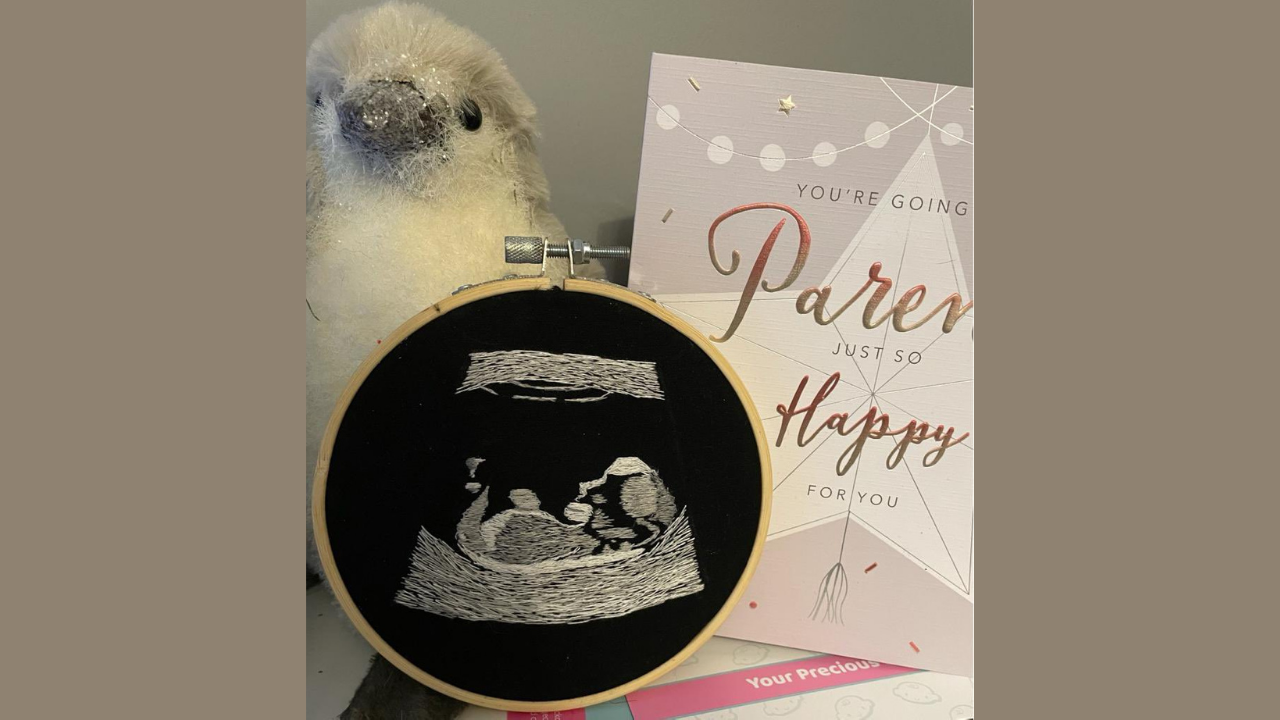 This Ultrasound Let Blind Dad "See" His Baby for the First Time Tinybeans(02)