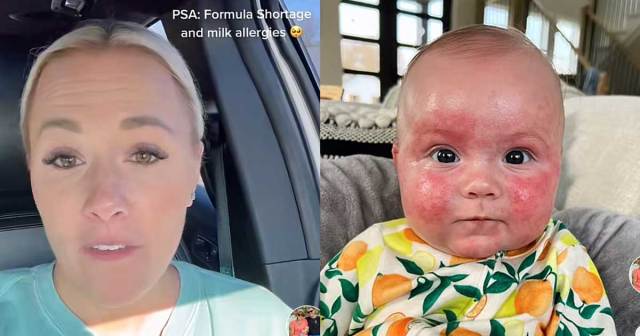 Mom Shares Terrifying Reality of Having a Baby With Allergies During the Formula Shortage