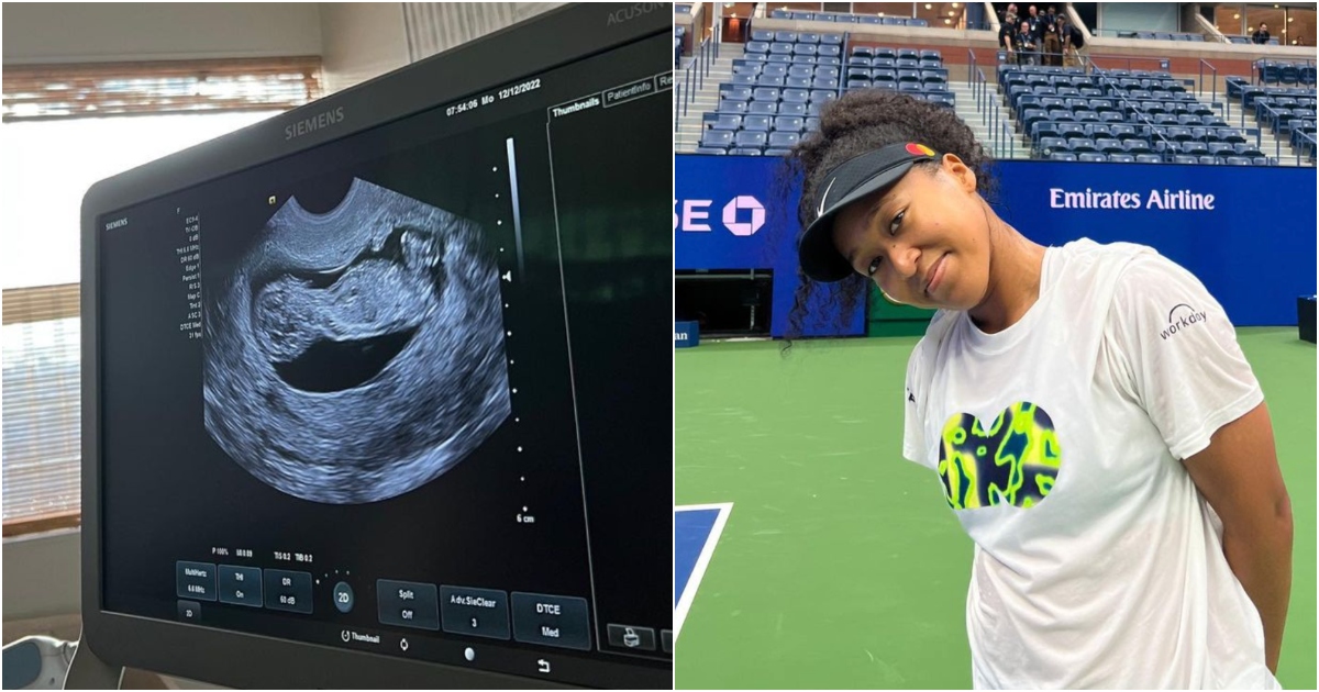 Naomi Osaka Announces She's Pregnant in Instagram Post