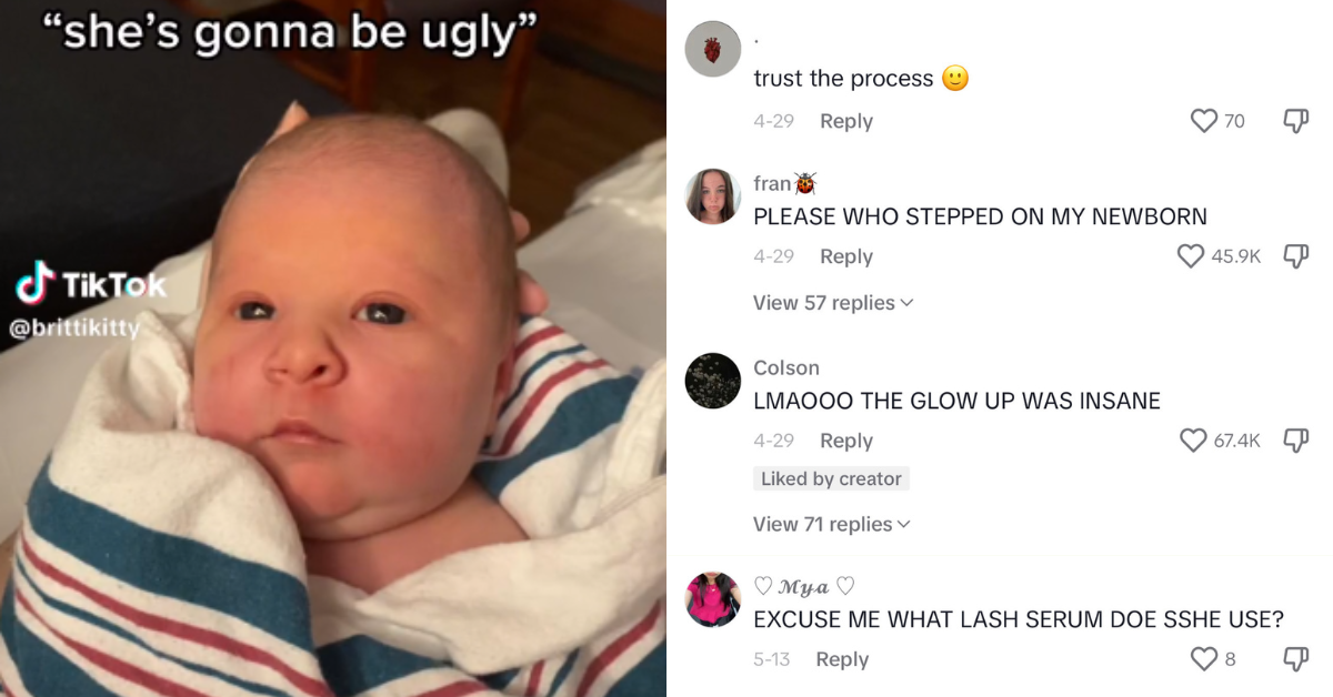 Mom Posts ’Ugly' Newborn’s Glow-Up & the Internet Is Horrified