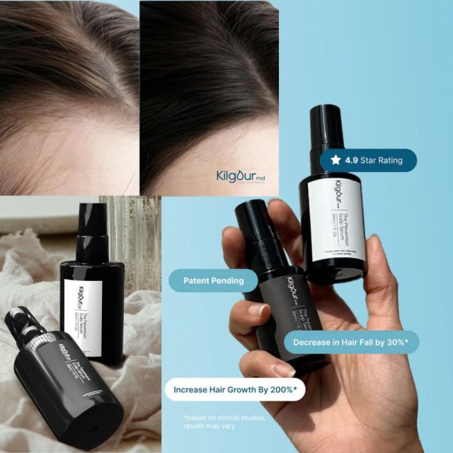 hair loss treatment system